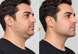 نمایش توضیحات خدمات مکمل زیبایی